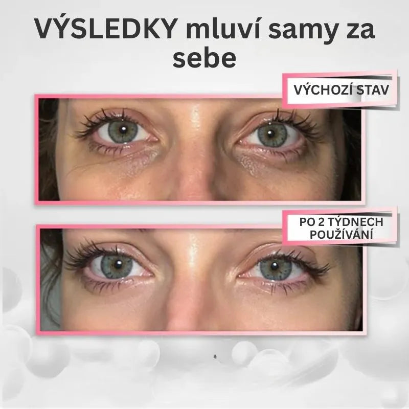 Terapia LED para el hogar – YUMA RevitalEyes