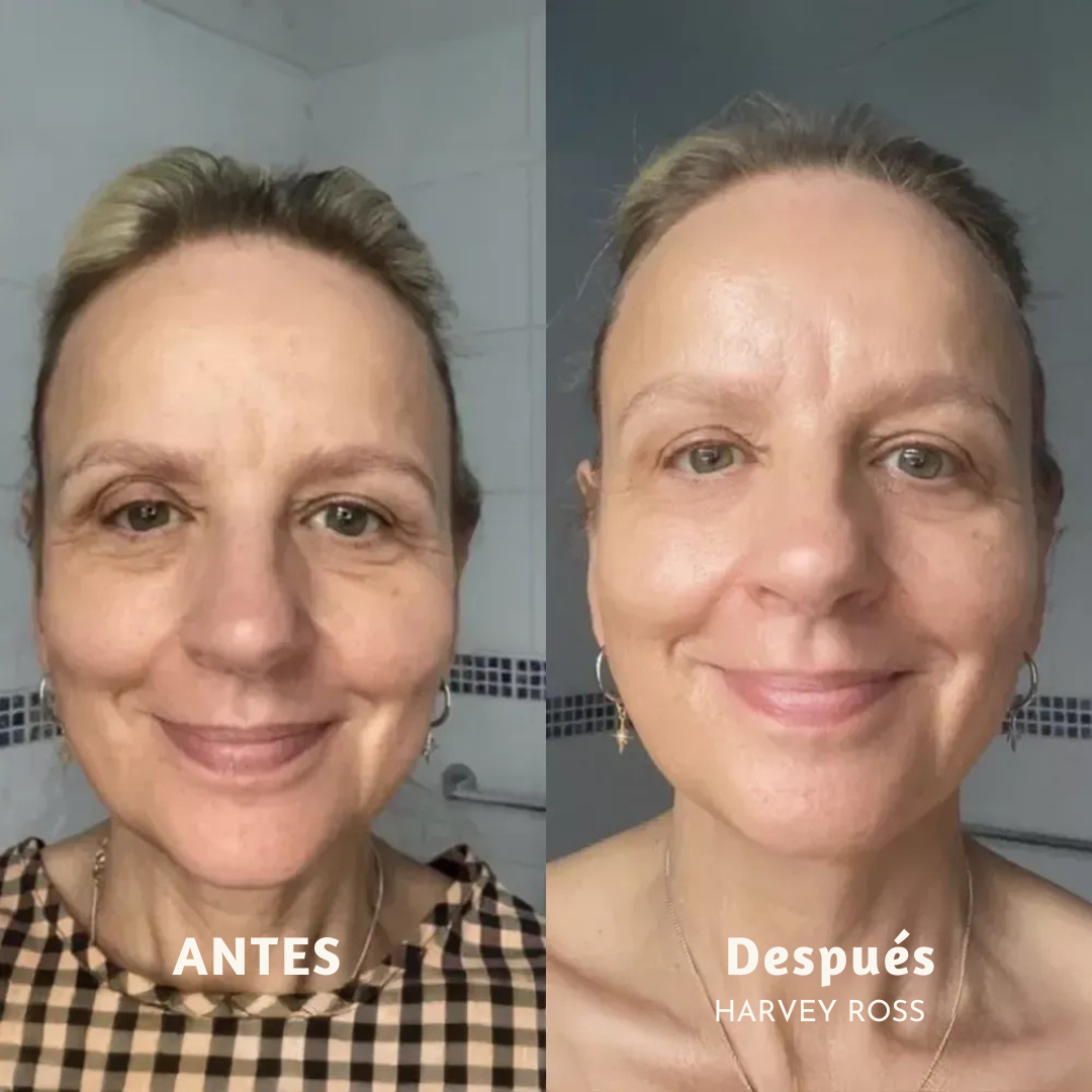 Yuma Beauty - harvey ross camuflaje lifting